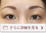眉・アートメイク施術例